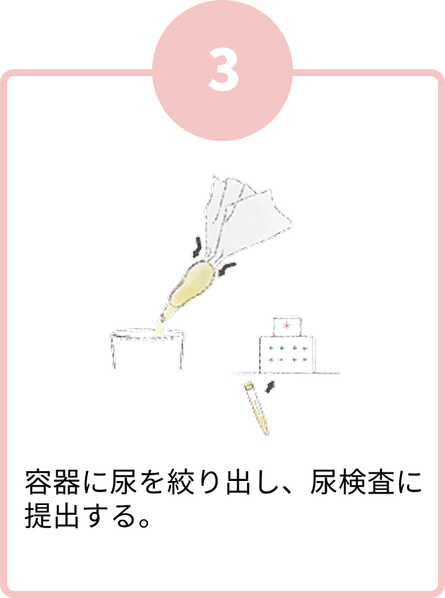 容器に尿を絞り出し、尿検査に提出する。