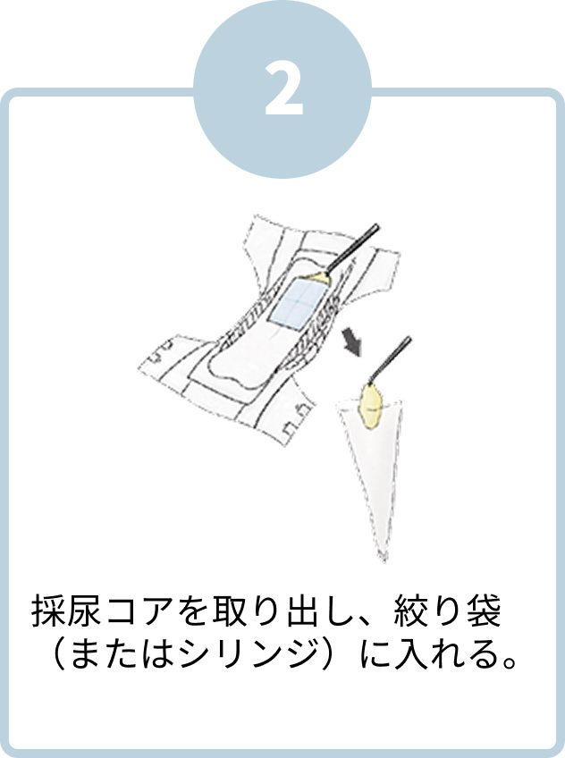 採尿コアを取り出し、絞り袋（またはシリンジ）に入れる。