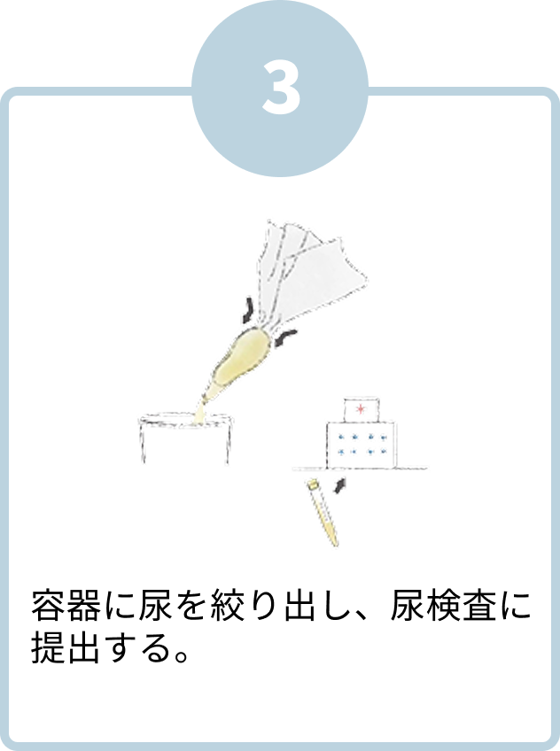 容器に尿を絞り出し、尿検査に提出する。