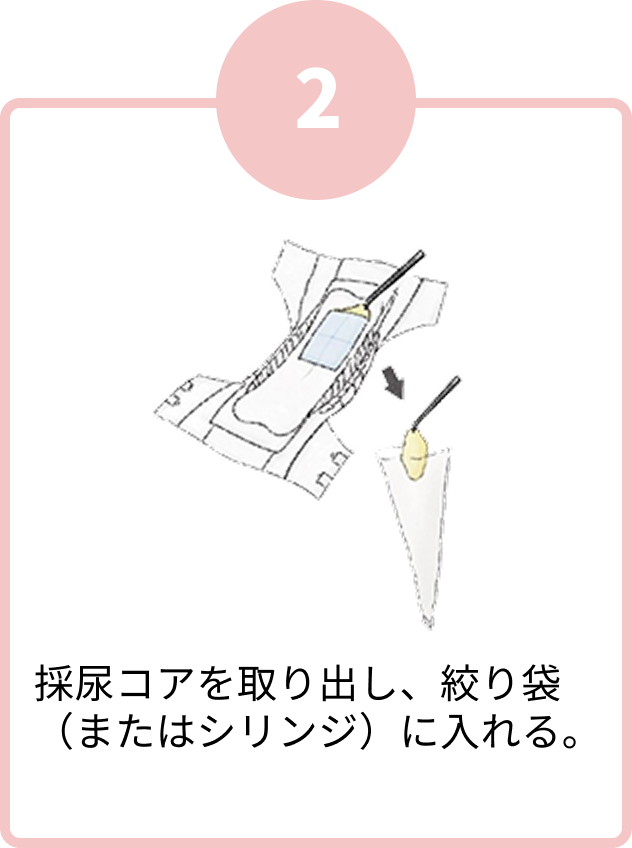 採尿コアを取り出し、絞り袋(またはシリンジ)に入れる。